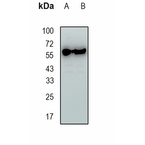 EYA2 Rabbit Monoclonal Antibody(C1688)