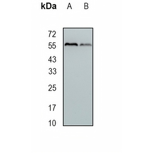 ALDH7A1 Rabbit Monoclonal Antibody(C1689)