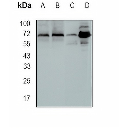 CIP4 Rabbit Monoclonal Antibody(C1691)