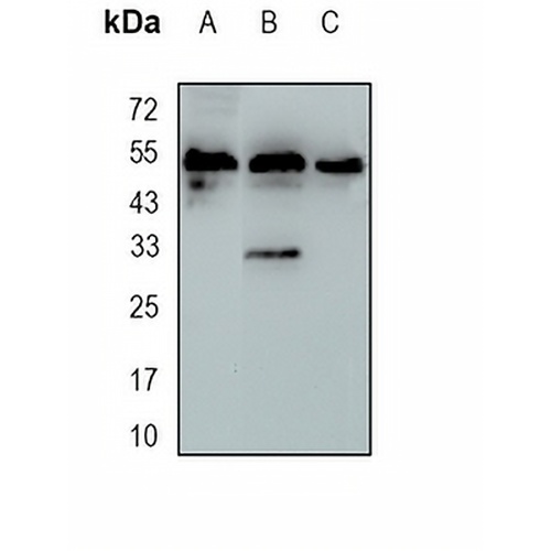 MPP1 Rabbit Monoclonal Antibody(C1692)
