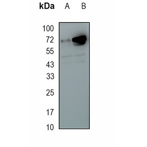 SSTR3 Rabbit Monoclonal Antibody(C1695)