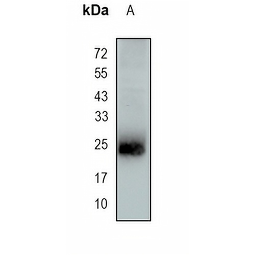 DNAJC12 Rabbit Monoclonal Antibody(C1697)