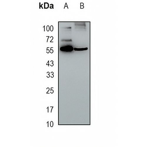PNKP Rabbit Monoclonal Antibody(C1698)