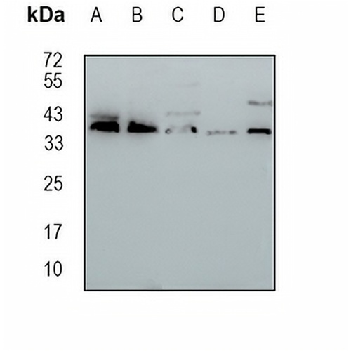 MRPS31 Rabbit Monoclonal Antibody(C1700)