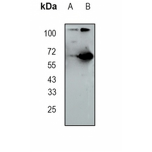 WDR1 Rabbit Monoclonal Antibody(C1702)
