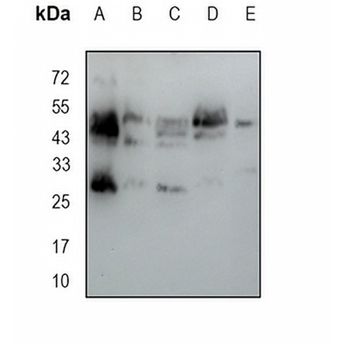 NGRH2 Rabbit Monoclonal Antibody(C1703)