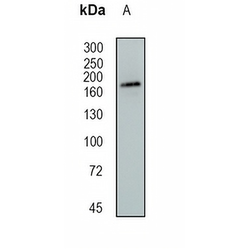 IQGAP2 Rabbit Monoclonal Antibody(C1704)