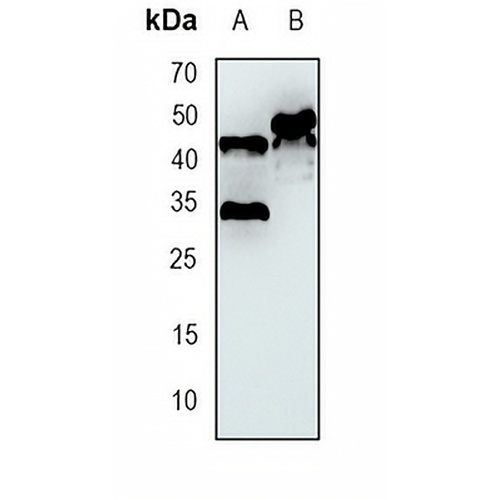GSK3 beta Rabbit Monoclonal Antibody(C1705)
