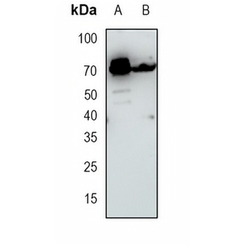 KIFC1 Rabbit Monoclonal Antibody(C1706)