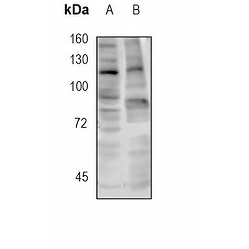 RNF20 Rabbit Monoclonal Antibody(C1707)