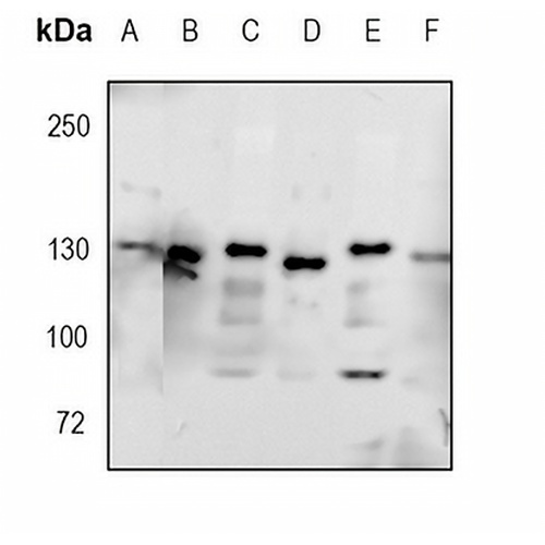 CD325 Rabbit Monoclonal Antibody(C1708)