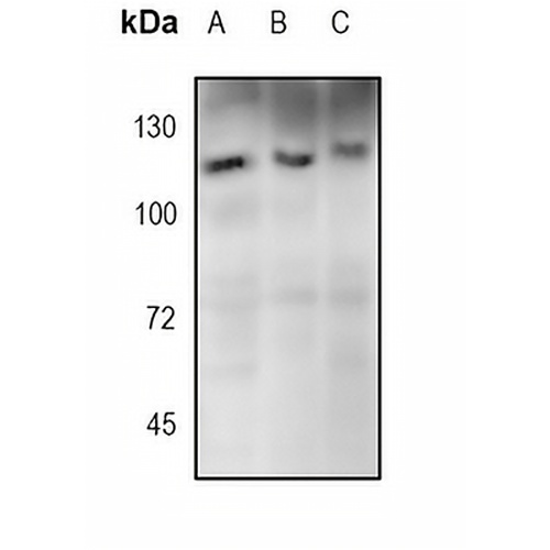 SIRT1 Rabbit Monoclonal Antibody(C1709)