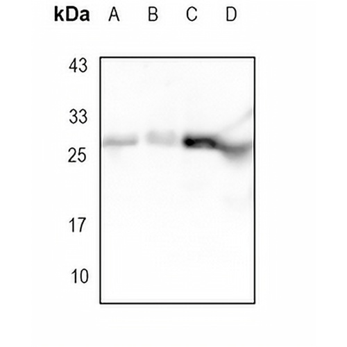 BCLX Rabbit Monoclonal Antibody(C1710)
