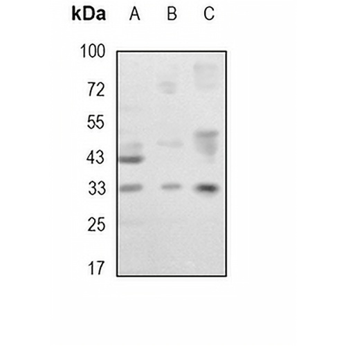 C/EBP beta Rabbit Monoclonal Antibody(C1711)