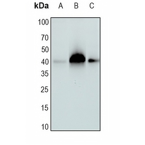 SETD7 Rabbit Monoclonal Antibody(C1712)
