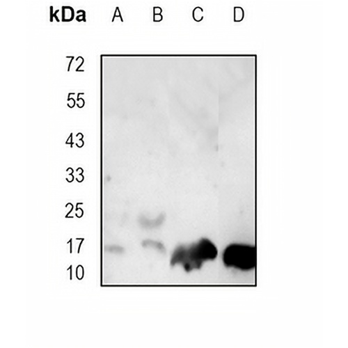 Survivin Rabbit Monoclonal Antibody(C1713)