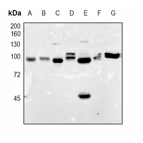 Aconitase 1 Rabbit Monoclonal Antibody(C1714)