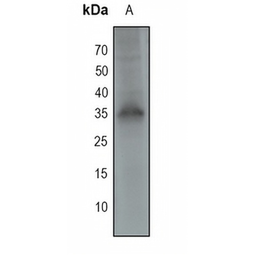 RAD51A Rabbit Monoclonal Antibody(C1715)