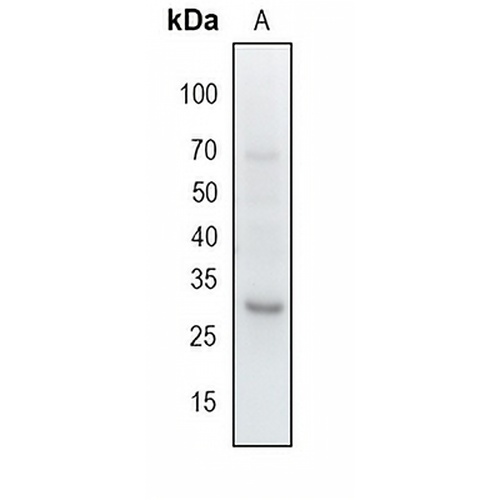 PNMTase Rabbit Monoclonal Antibody(C1716)