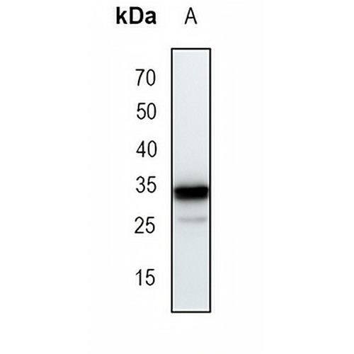 Arginase 1 Rabbit Monoclonal Antibody(C1718)