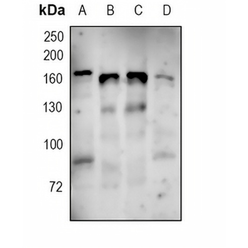 MSH6 Rabbit Monoclonal Antibody(C1720)