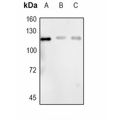 PMS2 Rabbit Monoclonal Antibody(C1722)