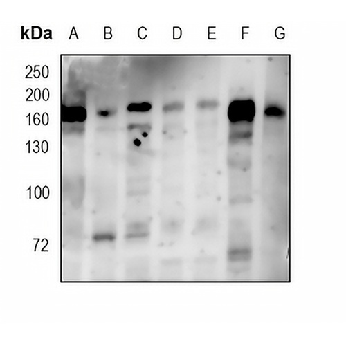 PDGFR beta Rabbit Monoclonal Antibody(C1723)
