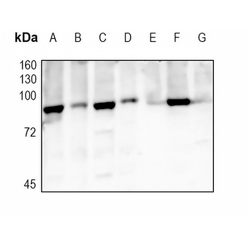 TBK1 Rabbit Monoclonal Antibody(C1724)