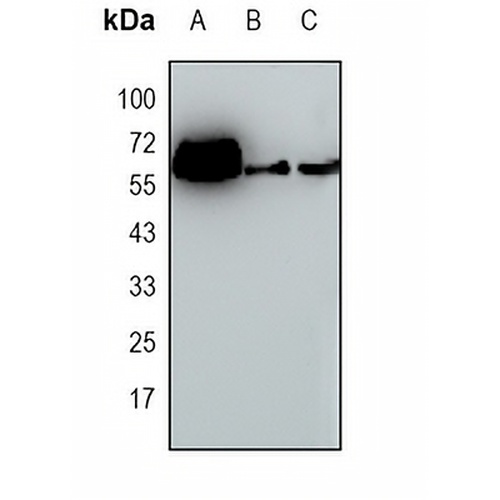 Amphiphysin 2 Rabbit Monoclonal Antibody(C1725)