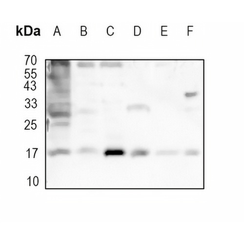 SUMO1 Rabbit Monoclonal Antibody(C1729)