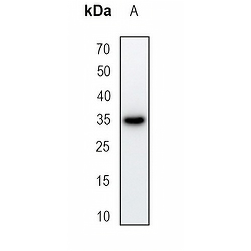 Nmi Rabbit Monoclonal Antibody(C1731)