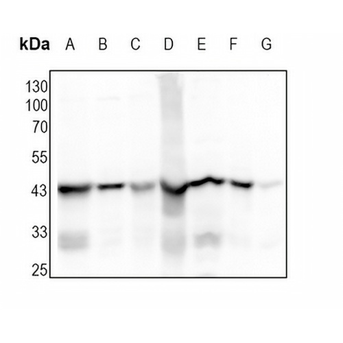 ACADM Rabbit Monoclonal Antibody(C1733)