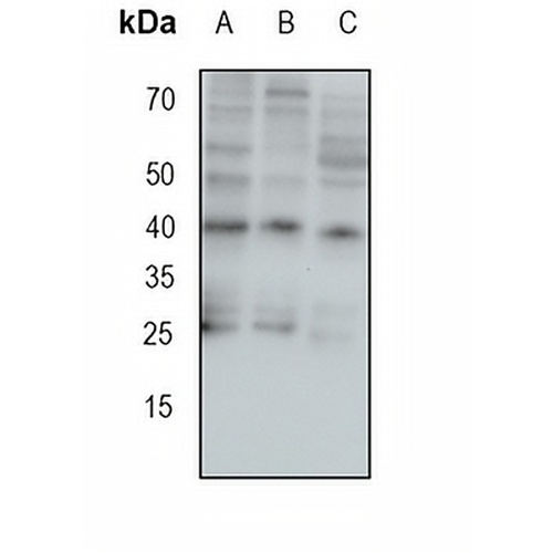 IRP Rabbit Monoclonal Antibody(C1736)