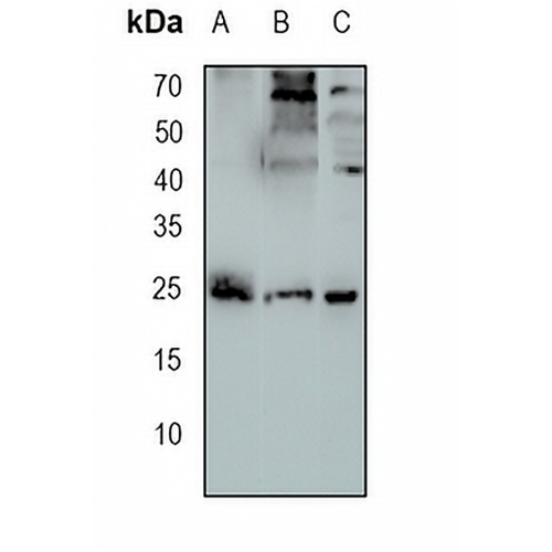 RAB11A Rabbit Monoclonal Antibody(C1737)