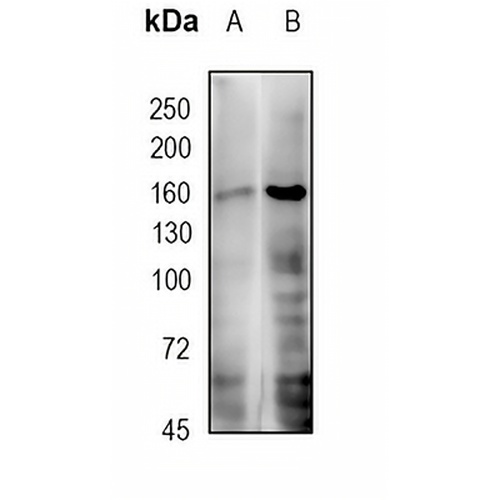 DOT1L Rabbit Monoclonal Antibody(C1738)
