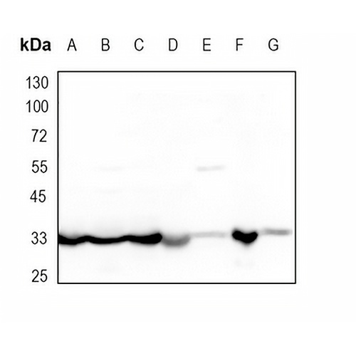 Osteopontin Rabbit Monoclonal Antibody(C1740)