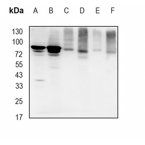 FOXO1 Rabbit Monoclonal Antibody(C1742)