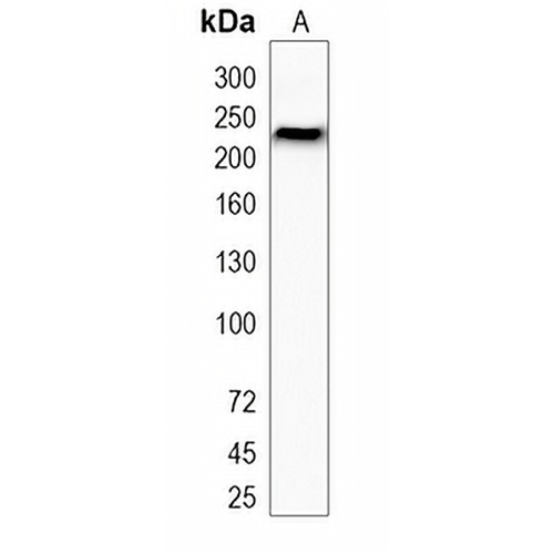 VEGFR2 Rabbit Monoclonal Antibody(C1743)