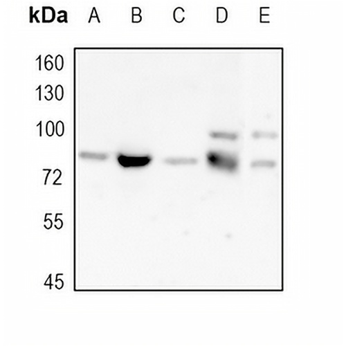 ABCD1 Rabbit Monoclonal Antibody(C1745)