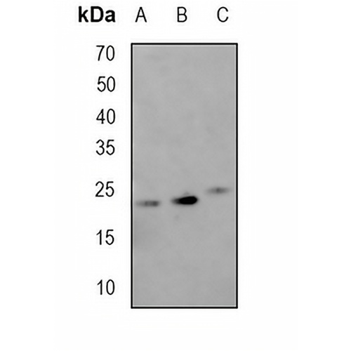 HN1 Rabbit Monoclonal Antibody(C1747)