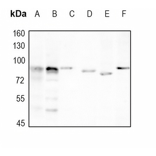 HIF1 beta Rabbit Monoclonal Antibody(C1749)
