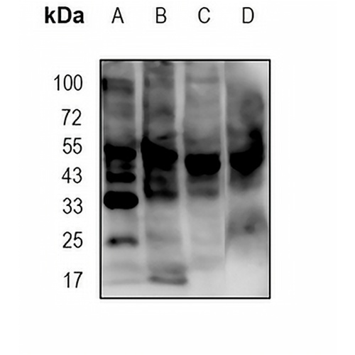 JNK1/2/3 (Phospho-T183+T183+T221) Rabbit Monoclonal Antibody(C1750)