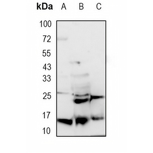 Lysozyme C Rabbit Monoclonal Antibody(C1751)