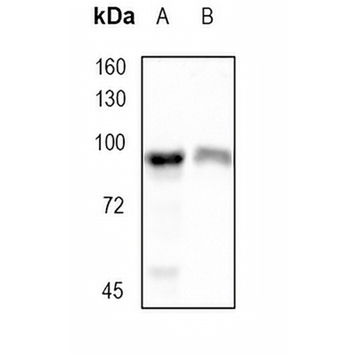 IKK beta Rabbit Monoclonal Antibody(C1752)