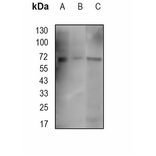 IRAK3 Rabbit Monoclonal Antibody(C1756)
