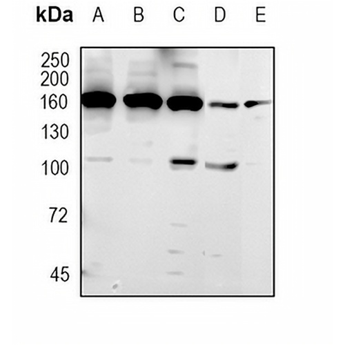 NSD3 Rabbit Monoclonal Antibody(C1757)
