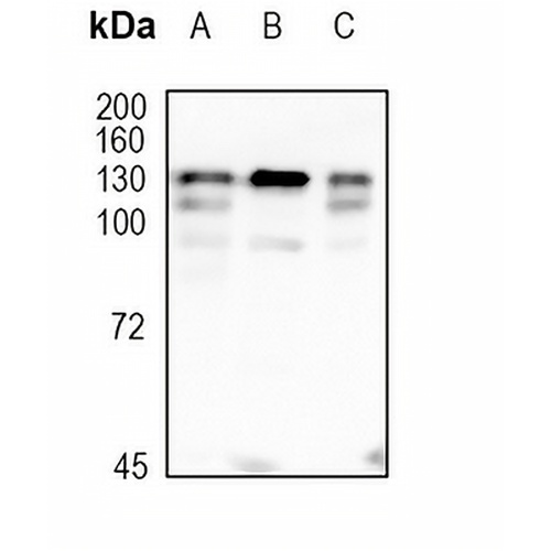 NEDD4L Rabbit Monoclonal Antibody(C1761)