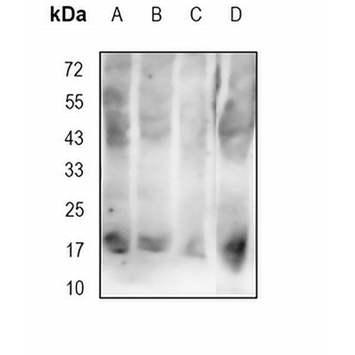 AGR2 Rabbit Monoclonal Antibody(C1763)