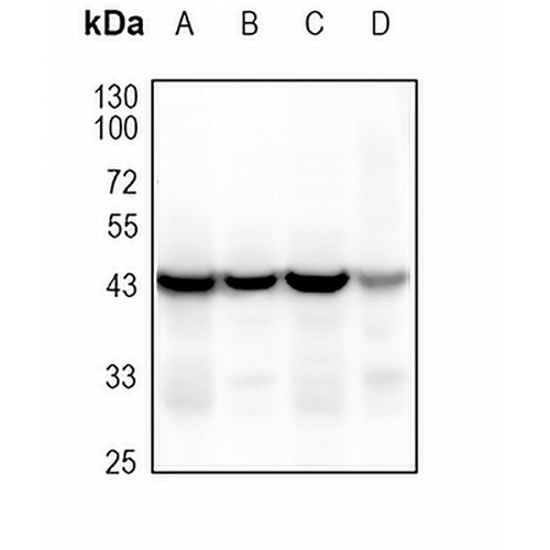 MKK2 Rabbit Monoclonal Antibody(C1766)