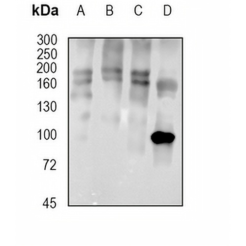 HDAC9 Rabbit Monoclonal Antibody(C1768)